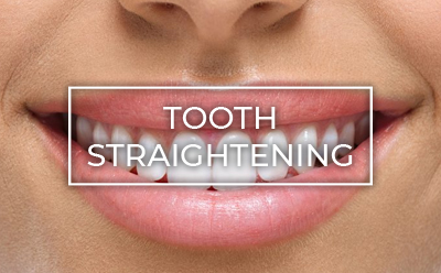 Tooth Straightening and Cosmetic Dentistry