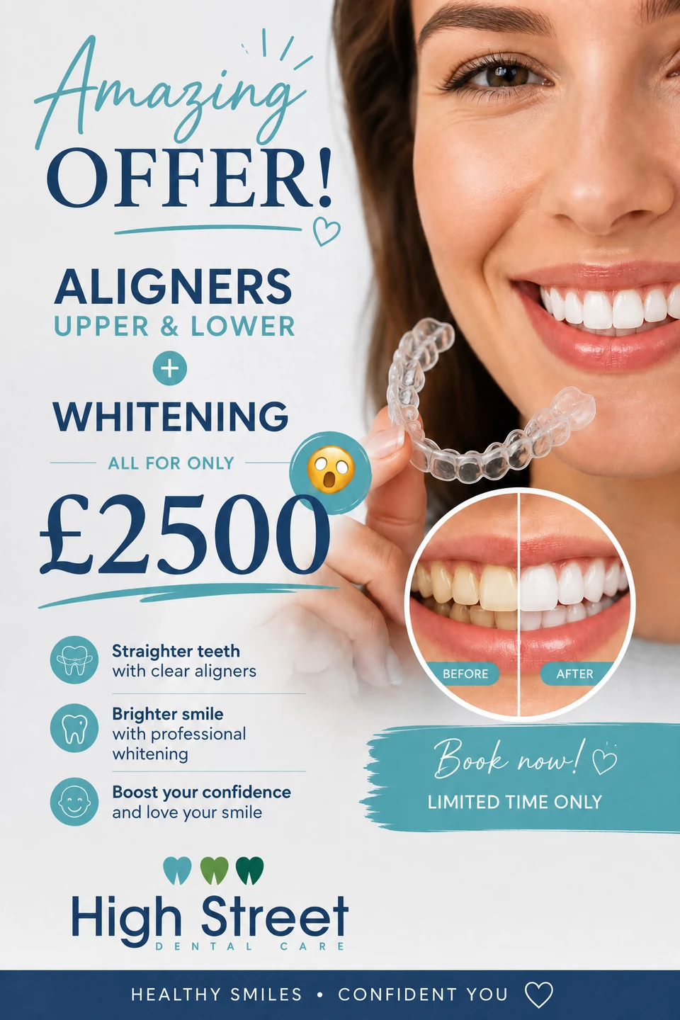 Amazing offer: aligners upper and lower plus whitening for £2500 at High Street Dental Care